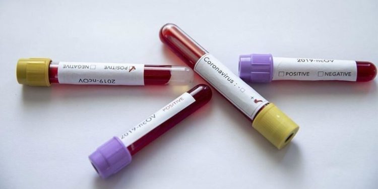 Avustralya’da koronavirüs tespit edilen vaka sayısı 41 oldu