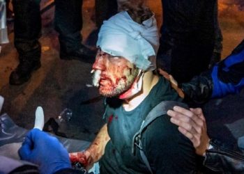 Paris’te polis şiddetine maruz kalan Suriyeli gazeteci Al Halbi o anları anlattı: Polis copla yüzüme vurdu