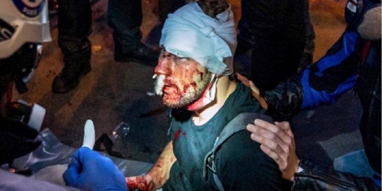 Paris’te polis şiddetine maruz kalan Suriyeli gazeteci Al Halbi o anları anlattı: Polis copla yüzüme vurdu