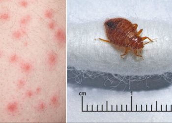 Fransa’nın başkenti Paris’i tahtakuruları bastı