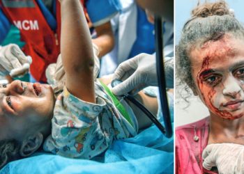 16 bin yaralı var hastane yok